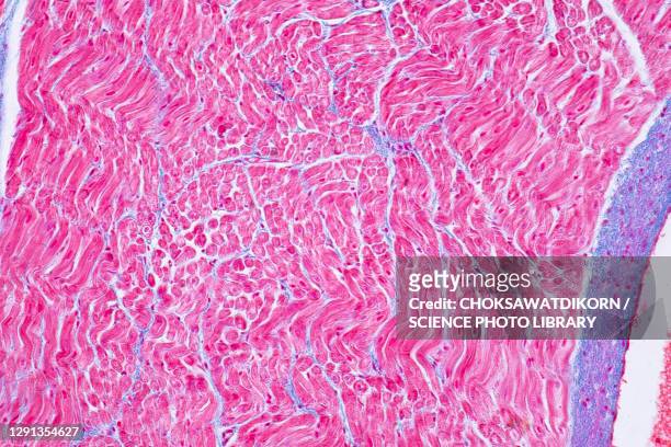 human cardiac muscle, light micrograph - cardiac muscle tissue stock pictures, royalty-free photos & images
