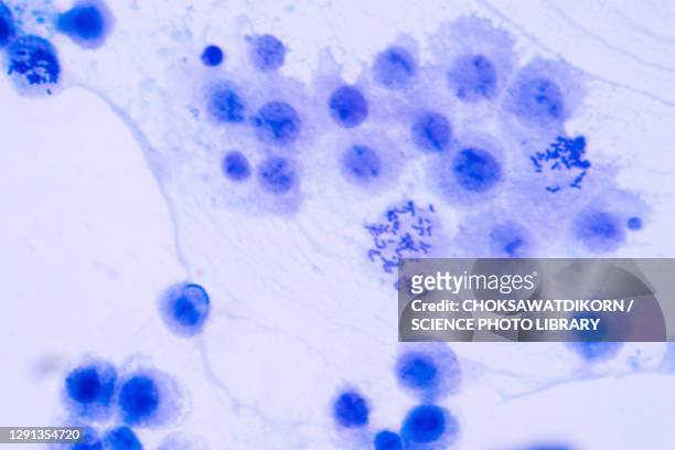 mitosis, light micrograph - 細胞分裂 個照片及圖片檔