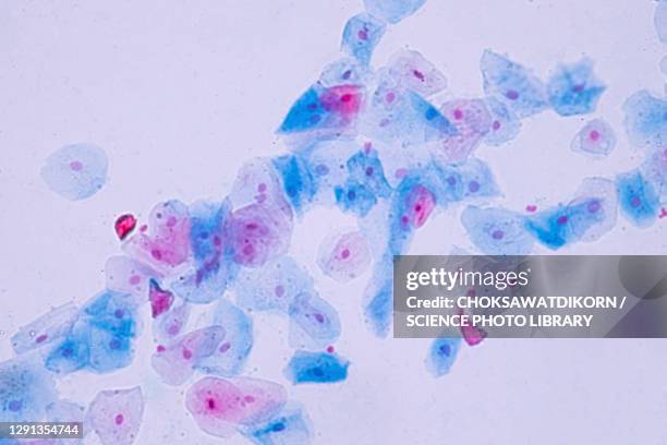 squamous epithelial cells, light micrograph - epitelio imagens e fotografias de stock