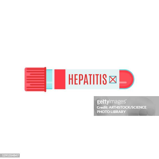 hepatitis, conceptual illustration - fabric swatch stock-grafiken, -clipart, -cartoons und -symbole