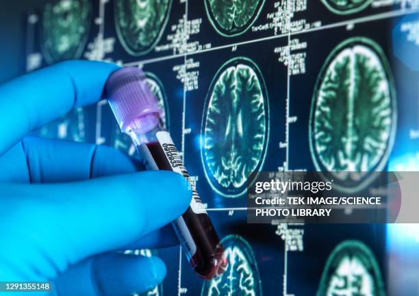 dementia research, conceptual image - medical research blood stock pictures, royalty-free photos & images