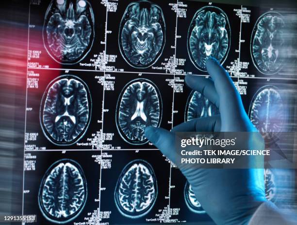 neurology diagnosis, conceptual image - mri scan stock pictures, royalty-free photos & images