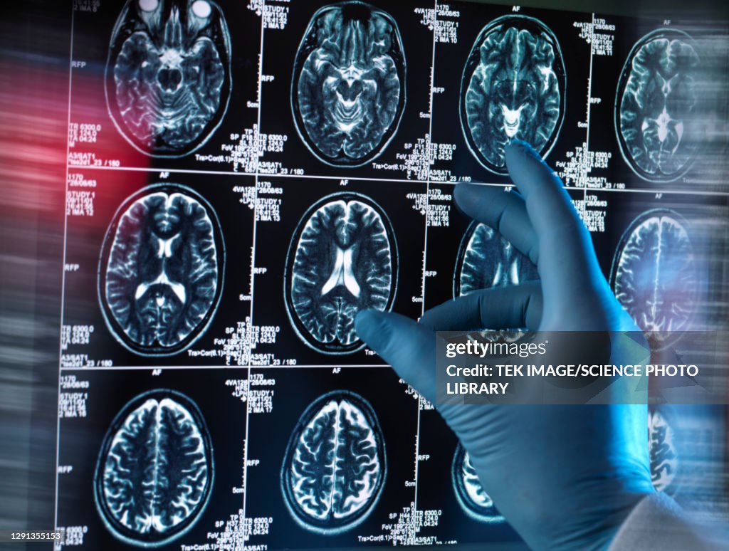 Neurology diagnosis, conceptual image