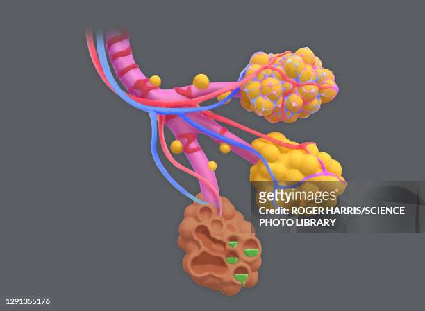 diseased alveoli, illustration - lungenbläschen stock-grafiken, -clipart, -cartoons und -symbole