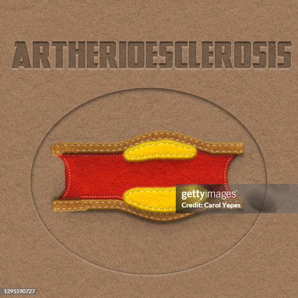 anatomical correct cross section through arteriosclerosis. in felt - arteria fotografías e imágenes de stock