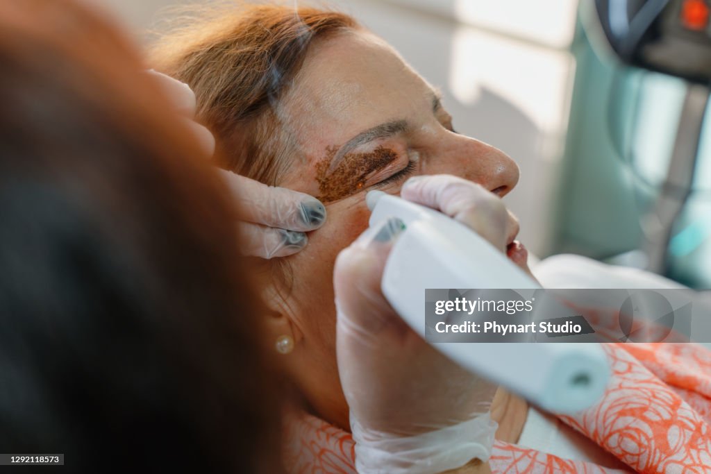 Cystic lesions, hyperpigmentation, palpebral ptosis, palpebrarum, plexr device, xanthelasma, blepharoplasty