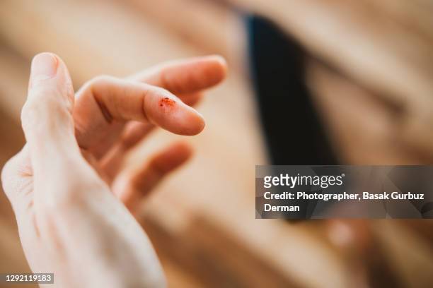 accidental knife cut - cut on finger 個照片及圖片檔