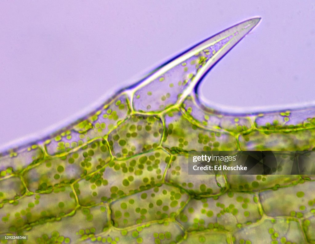 PHOTOSYNTHESIS--PHOTOSYNTHETIC PLANT CELLS WITH CHLOROPLASTS and basic PLANT CELL STRUCTURE, Elodea (an aquatic plant), 100X