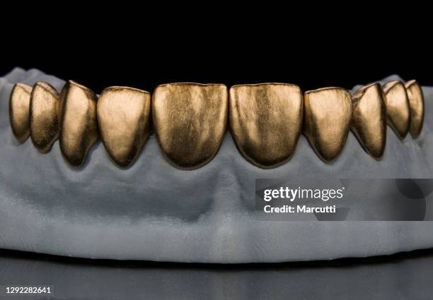 gold painted veneers - gold tooth stock-fotos und bilder