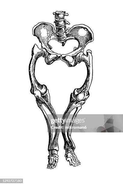 Black Rickets 25 Rickets Disease Stock Photos, High-Res Pictures, and Images - Getty ...