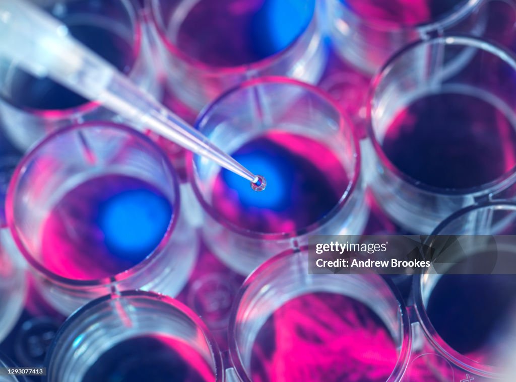 Cell research, Scientist pipetting samples into a multi well plate during an experiment in the lab with a screen image of cells in the background