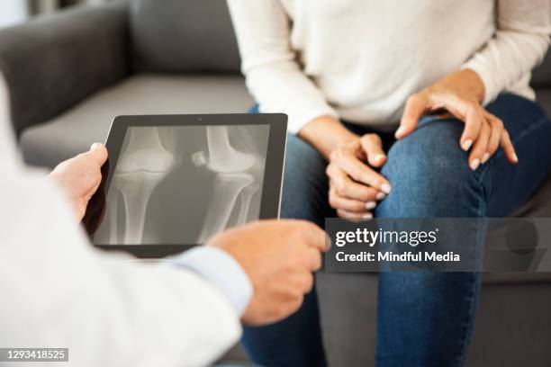 nahaufnahme des arztes, der sich das röntgenbild auf dem digitalen tablet ansieht - knee surgery stock-fotos und bilder