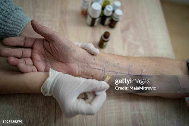 hautstichallergietest - allergietest stock-fotos und bilder