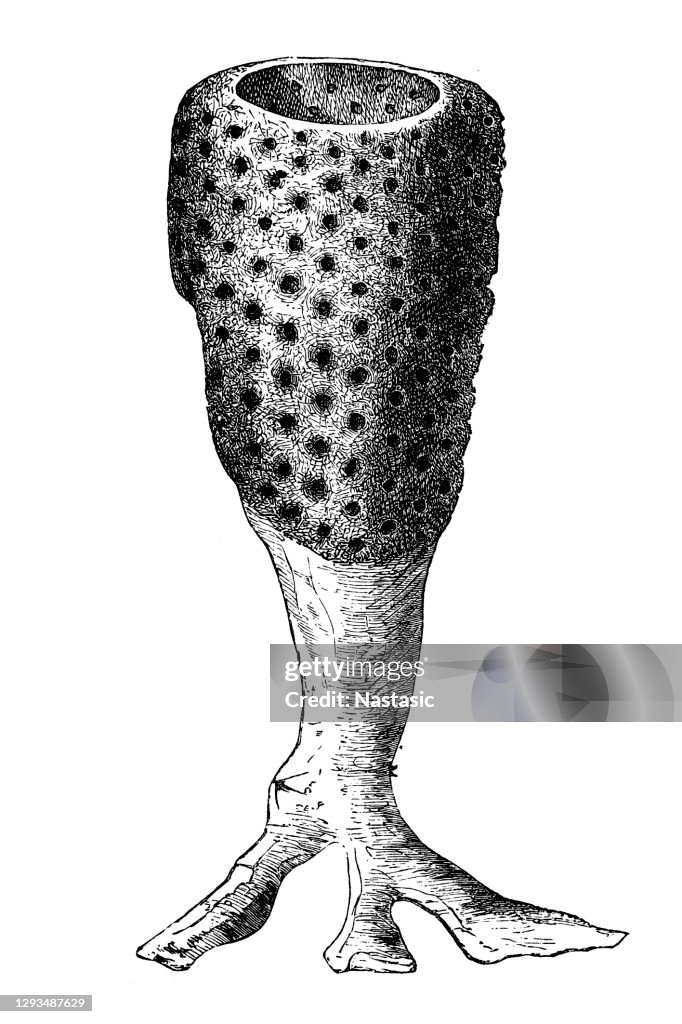 Ventriculitis simplex