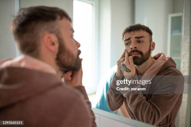 young man in bathrobe squeezing blackhead on his cheek - pimple stock pictures, royalty-free photos & images
