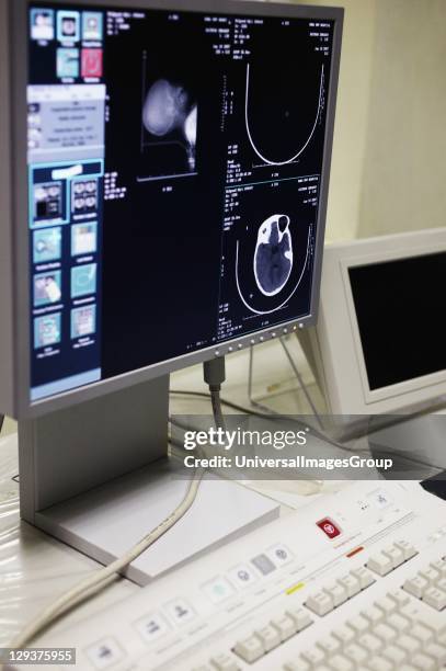 Ct Scanner Control Computer 853 Ct Scan Machine Stock Photos, High-Res Pictures, and Images - Getty ...