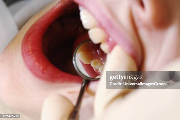 Dentist inspecting boys mouth before treatment