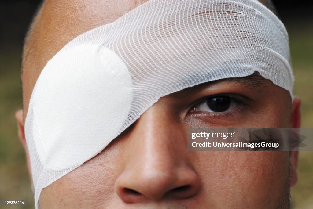 Man wearing eye patch