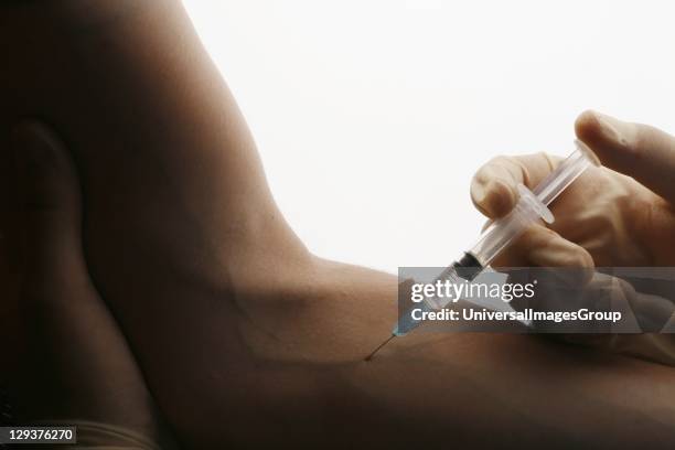 Corporal Injection Forearm Injection Photos and Premium High Res Pictures - Getty Images