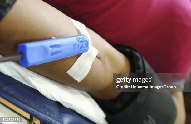 Cannula inserted into the arm of blood donor