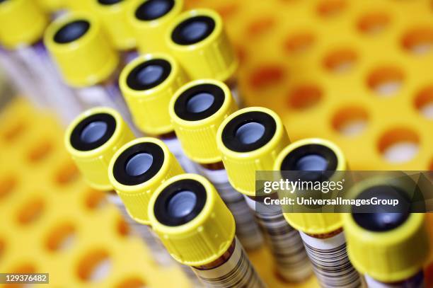 Barcoded tubes contain donated blood which is now ready for testing