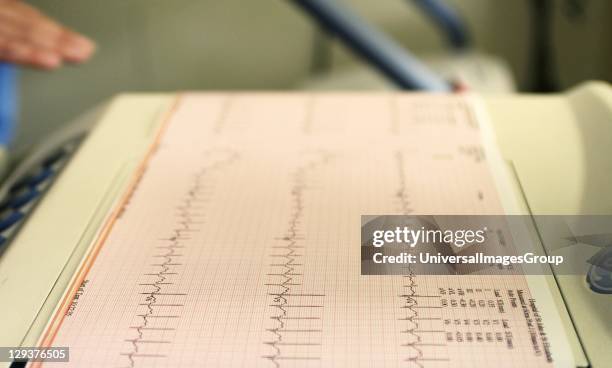 Electrocardiogram recording of patients cardiac cycle produced by electrocardiograph
