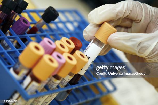 633 Blood Tubes Rack Stock Photos, High-Res Pictures, and Images ...