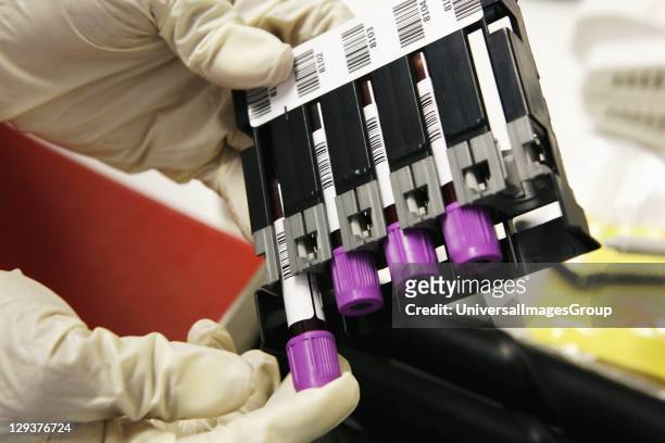 Laboratory technician removing bar coded blood specimens from test tube holder