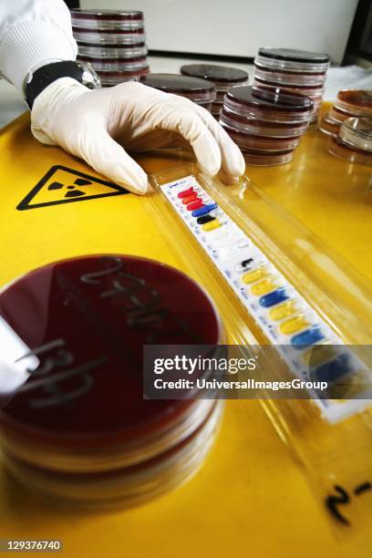 Blood poisoning bacteria colonies being cultured on agar medium