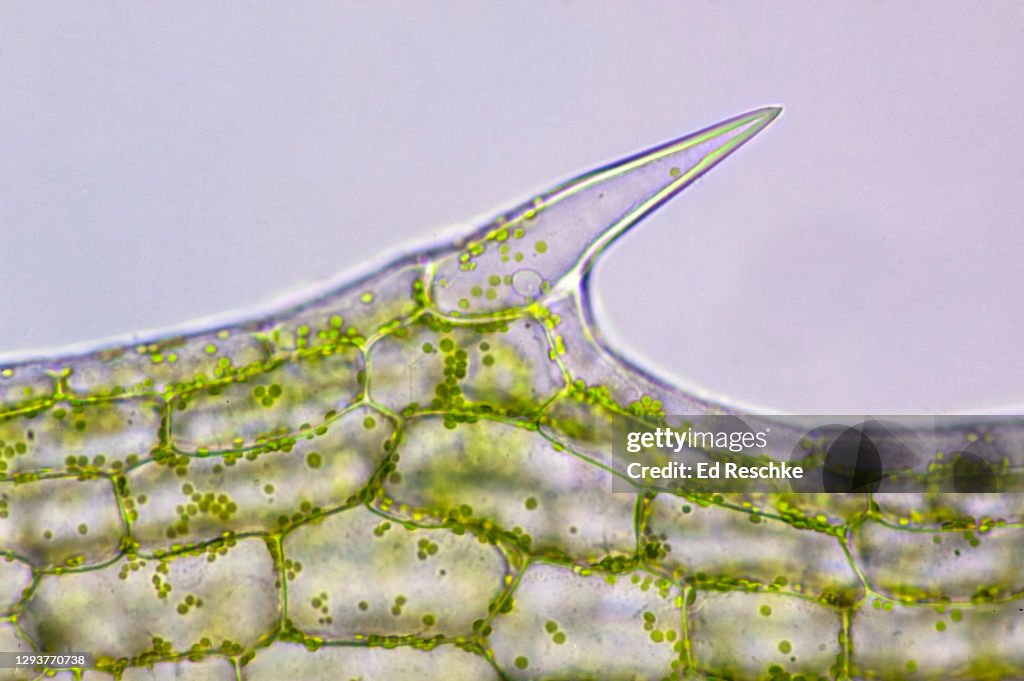 PLANT CELL ANATOMY---PHOTOSYNTHETIC PLANT CELLS WITH CHLOROPLASTS, 100X