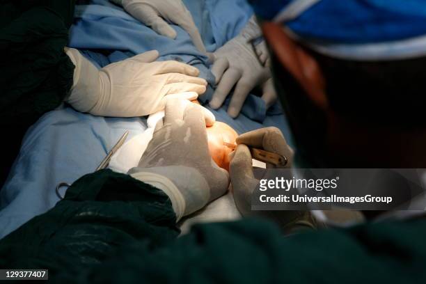 Surgeon making first incision to remove neurofibroma from hand