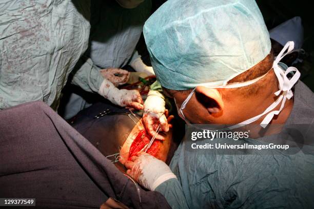 Surgeons stitching surgical wound