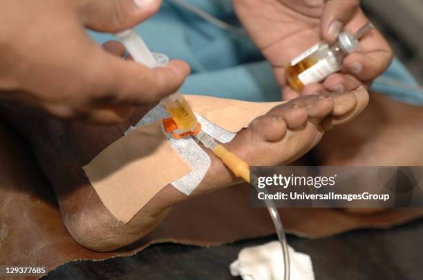 Anaesthetist injecting drugs through cannula into patients foot