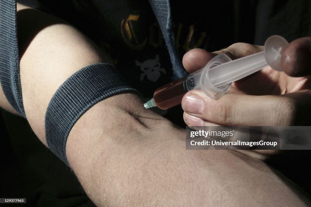 Re-enactment of heroin user burning heroin on spoon