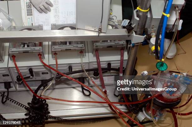 Cardiopulmonary bypass machine connected and in use, also known as the Heart-Lung Machine. Sudan, Africa., A connected and in use Cardiopulmonary...