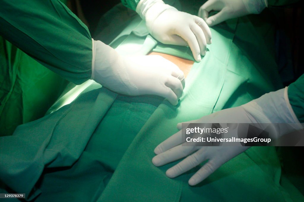 Patient is being prepared for surgical removal of vermiform appendix