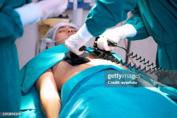 läkare använder en defibrillator till patient på operationssalen. - defibrillator bildbanksfoton och bilder