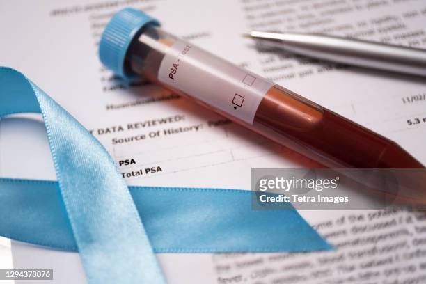close-up of prostate cancer blue ribbon and blood sample - psa stockfoto's en -beelden