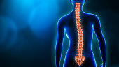 Curvature of the spine and woman body back view 3D rendering illustration with copy space. Spine disorder, scoliosis, backbone injury, human anatomy and medical concepts.