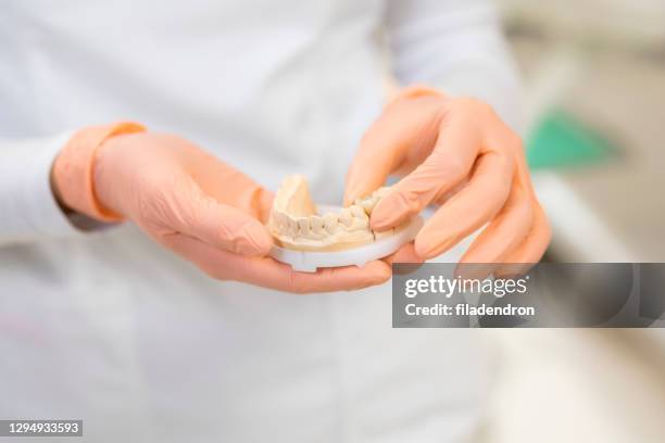 moule dentaire de plâtre dans les mains du dentiste - bridge stock photos et images de collection