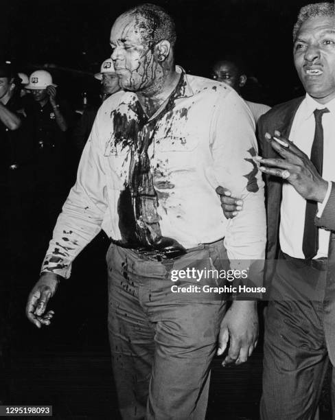 An injured man, with blood from a head wound on his face and shirt, is escorted by African American civil rights activist Bayard Rustin through the...