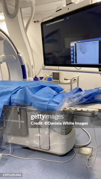 an angiograph - angiogram stock pictures, royalty-free photos & images