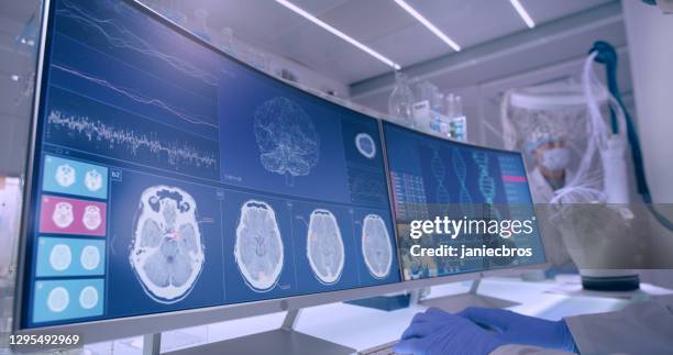 laboratory equipment, microscope and computers. brainwave research on screens. side view of scientist - brain activity stock pictures, royalty-free photos & images