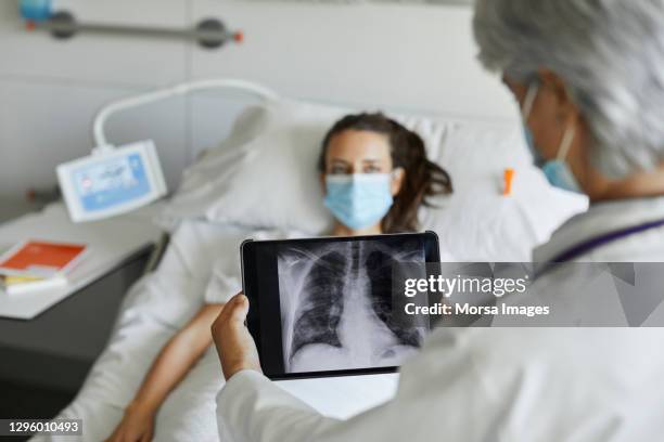 doctor with digital x-ray by patient in icu - lung fotografías e imágenes de stock