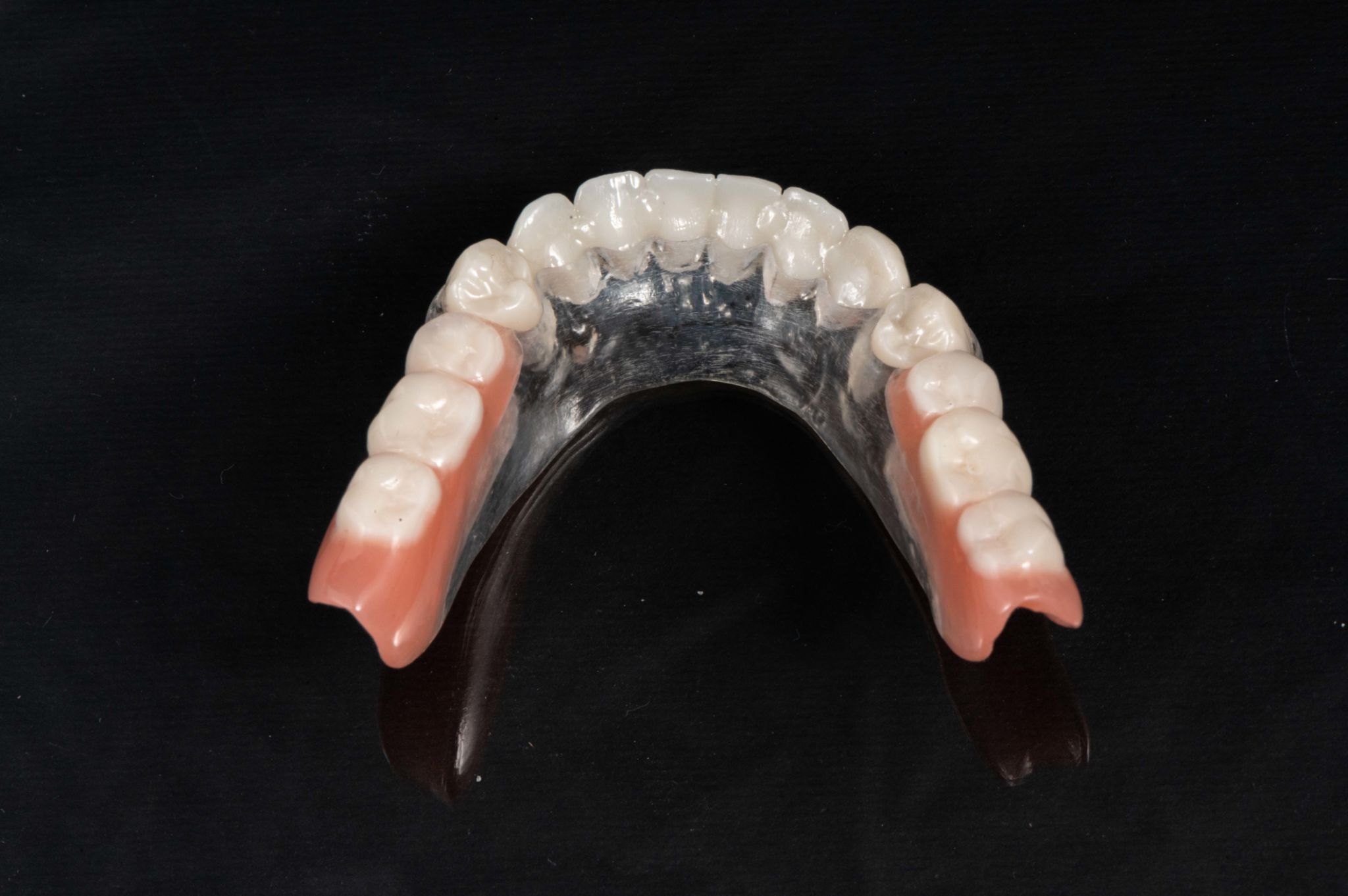impianti dentali