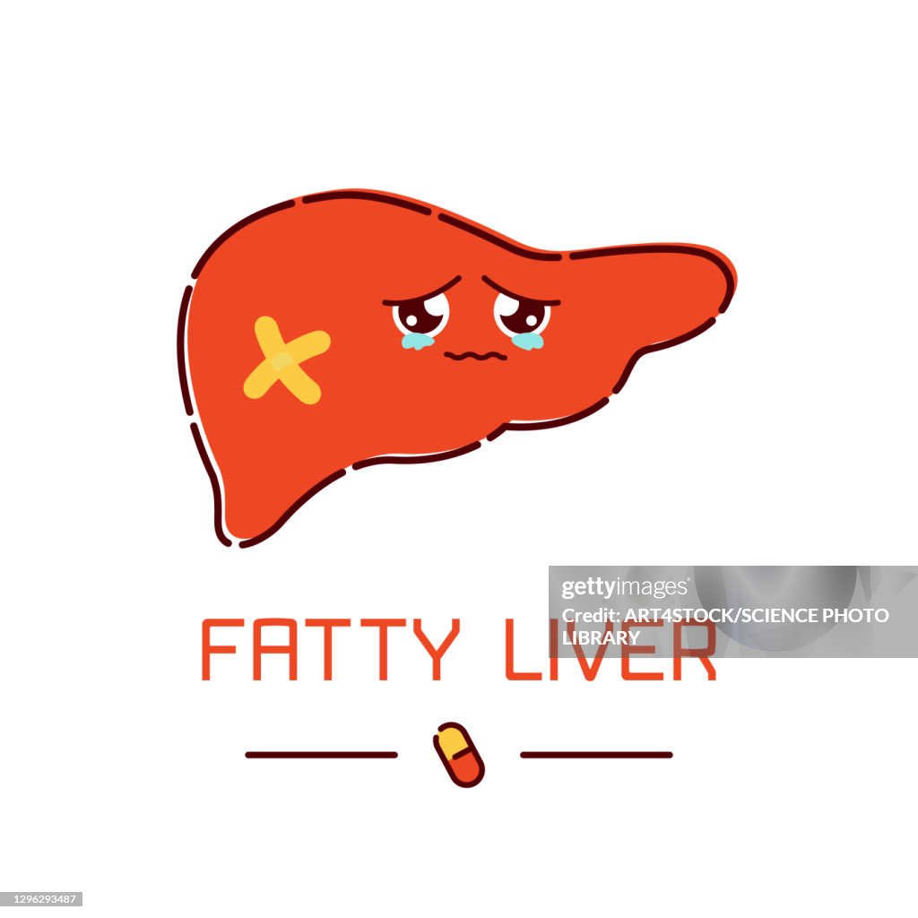 Fatty liver, conceptual illustration