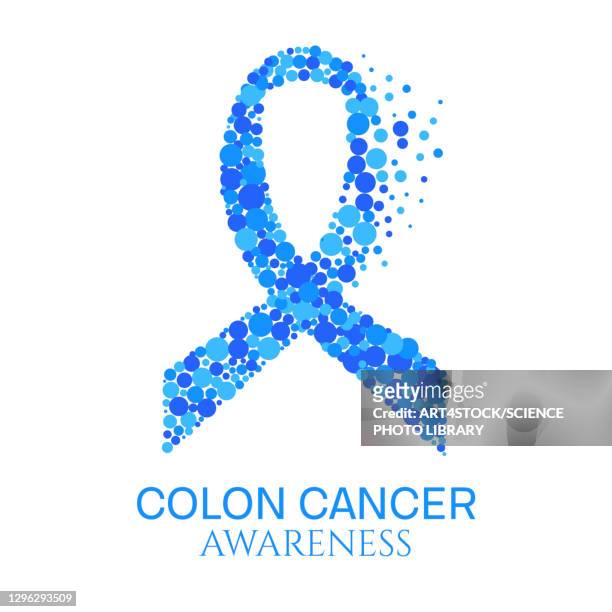 colon cancer, conceptual illustration - colon cancer stock illustrations