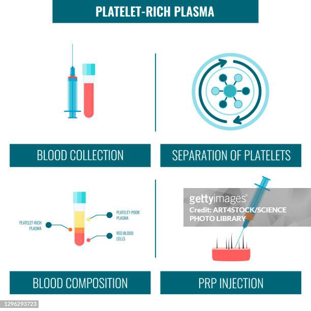 platelet rich plasma hair treatment, illustration - alternative therapy stock illustrations
