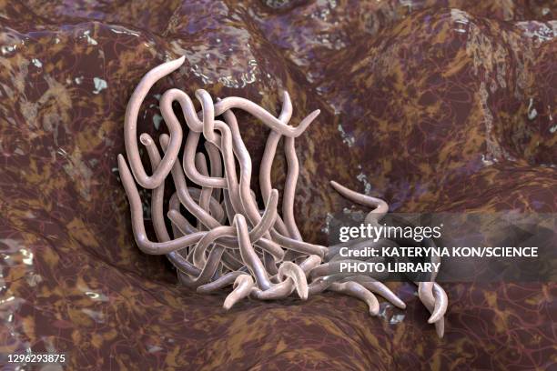 142 Pinworm Stock Photos High Res Pictures And Images Getty Images 142-pinworm-stock-photos-high-res-pictures-and-images-getty-images