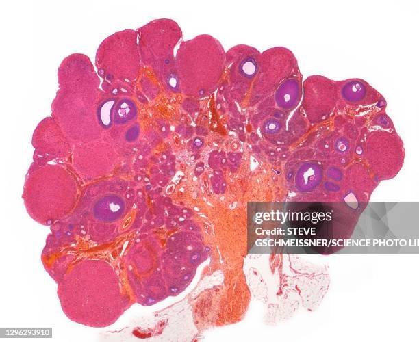 ovary, lm - sistema reprodutor feminino imagens e fotografias de stock